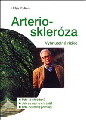 Arterioskleróza. Vyhnutelné riziko