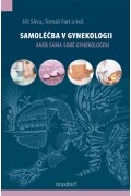 Samoléčba v gynekologii aneb Sama sobě gynekologem
